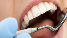 Gingival Diseases
