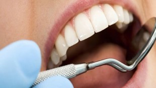 Gingival Diseases
